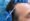 Hair Restoration with Natural Growth Factors