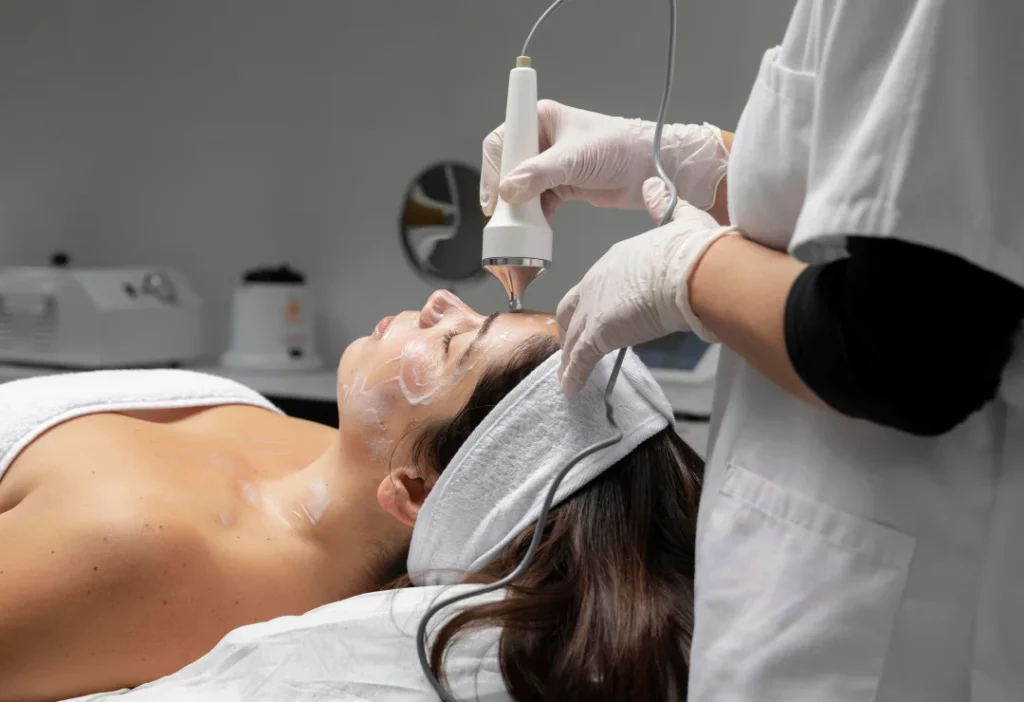 facial laser acne treatment